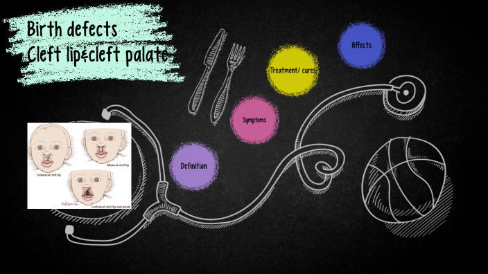 Birth defects Project by Anilya Smith on Prezi
