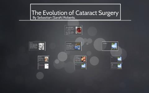 The Evolution of Cataract Surgery by Sebastian Roberts on Prezi
