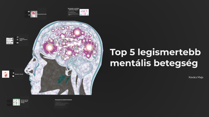 Top 5 legismertebb mentális betegség by Maja Kovács on Prezi