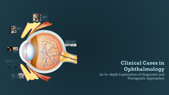 Clinical Cases in Ophthalmology by Leszek Borzemski on Prezi