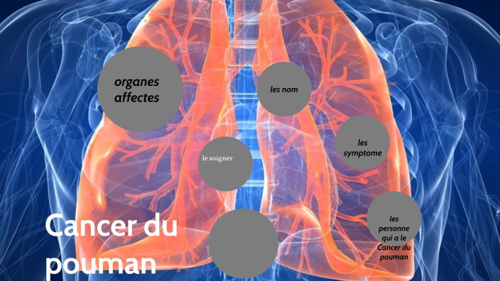 Cancer du pouman by Charley Germin ANN on Prezi