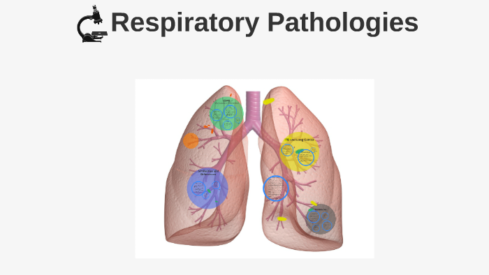 Bio20: Human Systems: Respiratory Pathologies by on Prezi