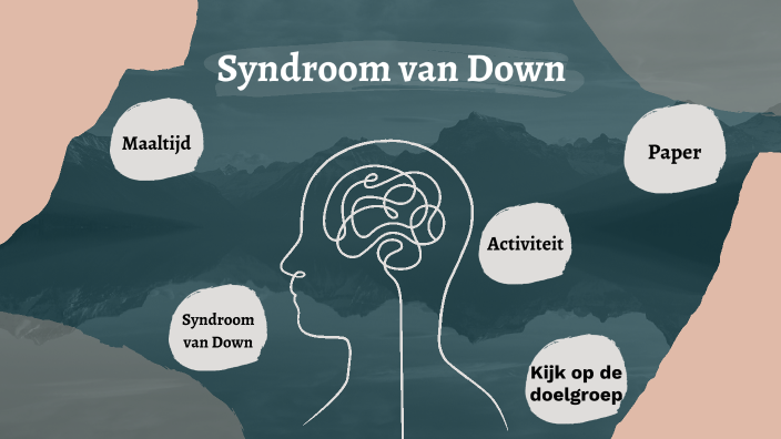Syndroom van Down by Luana De Bruyne on Prezi