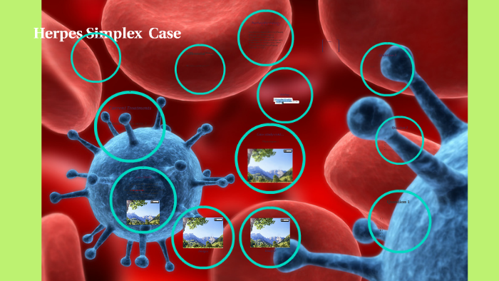 Herpes Simplex Case by on Prezi