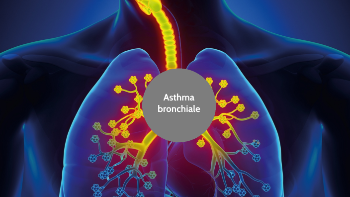 Asthma Bronchiale By Lina Matscheko On Prezi