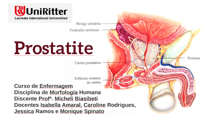 Prostatites Vesiculites)