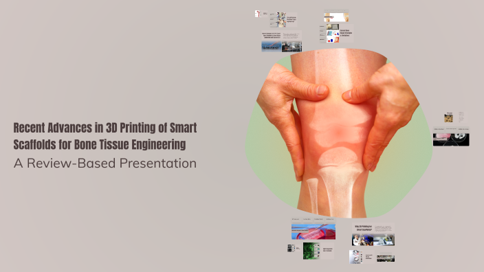 Recent Advances in 3D Printing of Smart Scaffolds for Bone Tissue ...