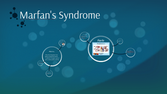 Marfans Syndrome by Kaylee Titus