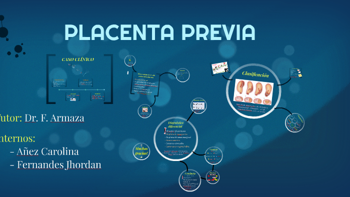 PLACENTA PREVIA by Carolina Añez Cabrera