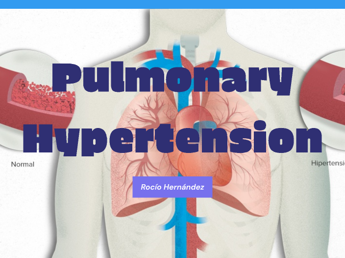 Pulmonary Hypertension By Rocío Hernández On Prezi