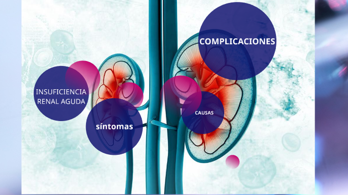 INSUFICIENCIA RENAL by Leslye Vélez on Prezi