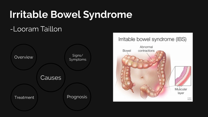 IBS HS by Looram Taillon on Prezi