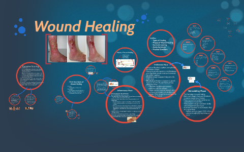 Wound Healing by Jason Nealy on Prezi