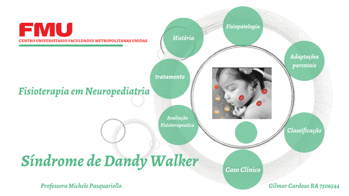 Síndrome de Dandy Walker 1 by Gil Cardoso on Prezi