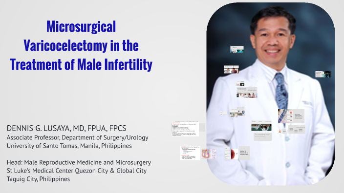 Microsurgical Varicocelectomy in the Treatment of Male Infertility by ...