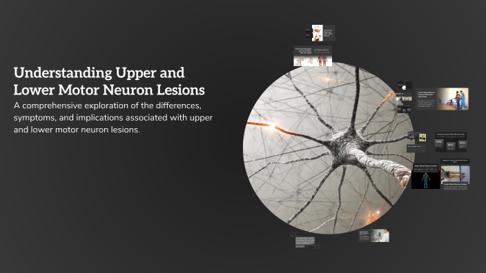Understanding Upper and Lower Motor Neuron Lesions by Mohamed Hany on Prezi